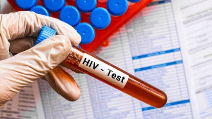 Fiji Declares HIV A National Crisis As Diagnoses Surge 27%