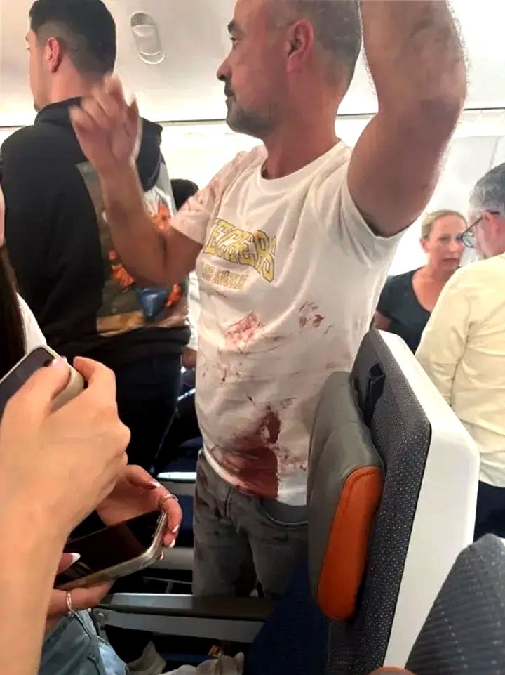 A passenger on the diverted flight was pictured having blood on his shirt.