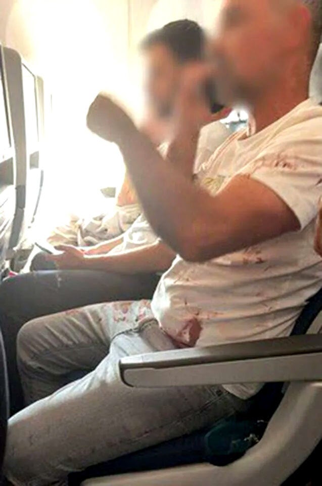A passenger seated in an aisle seat was pictured having blood on his shirt.