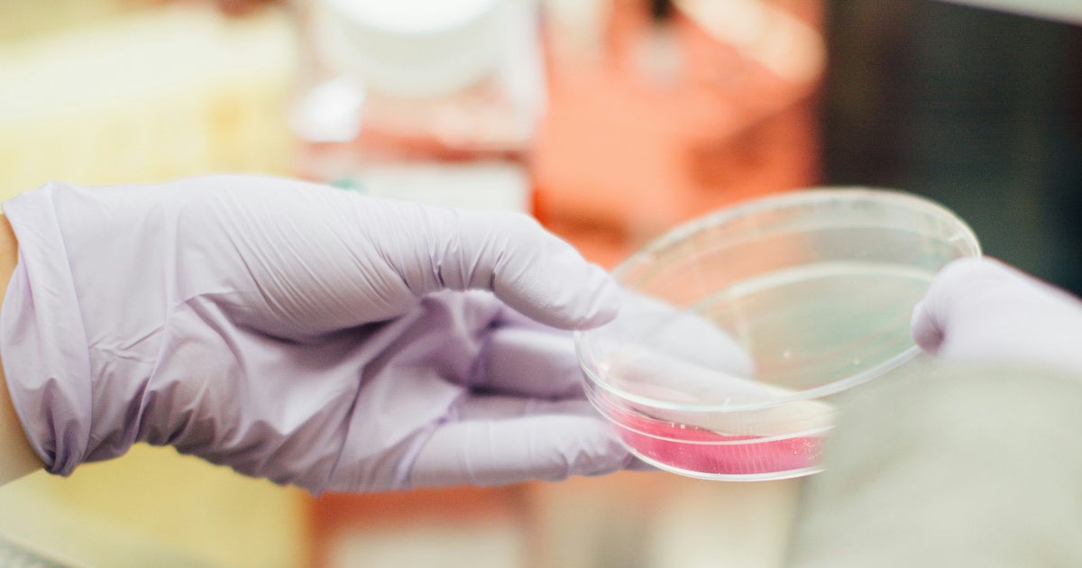 'Zombie Cells' Build Up As We Age. Researchers Now Think They Know Why