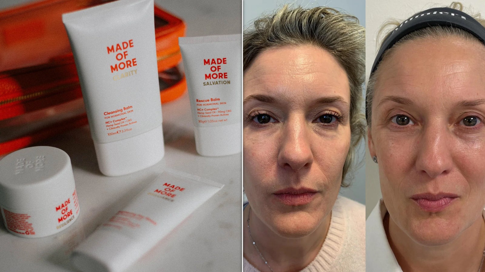 Reviewers Love This £25 Rescue Balm For Calming Menopausal Skin