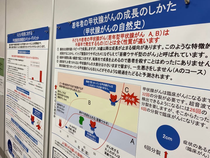 企画展「福島の甲状腺検査と甲状腺がんのほんとうを知ろう」で貼り出された甲状腺がんの自然史（福島県郡山市、2025年11月29日撮影）