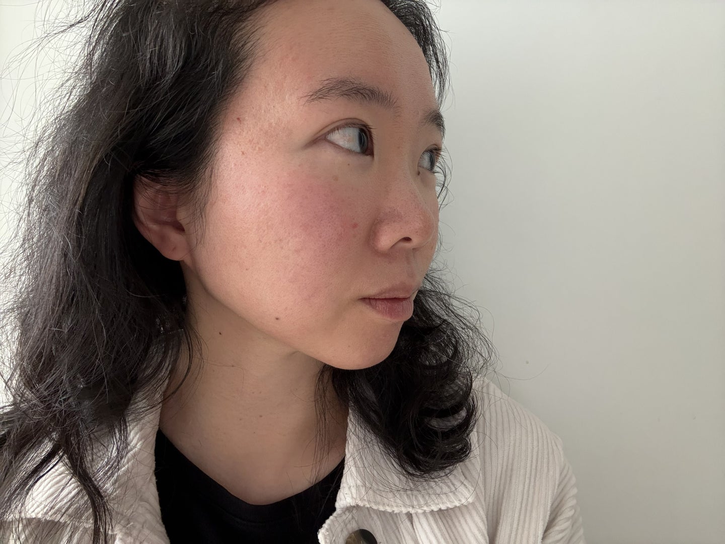 Rednees I Have Redness-Prone Skin, And This New Foundation Is Saving Me ...