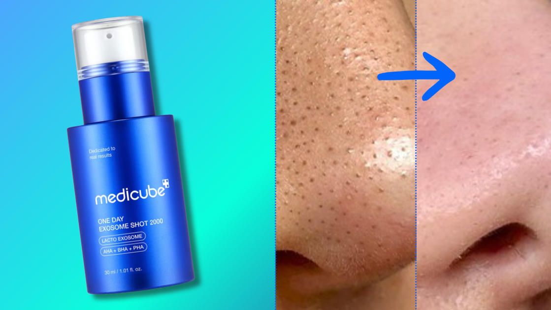 Rezensenten bezeichnen dieses straffende Serum als „Botox in der Flasche“ ...