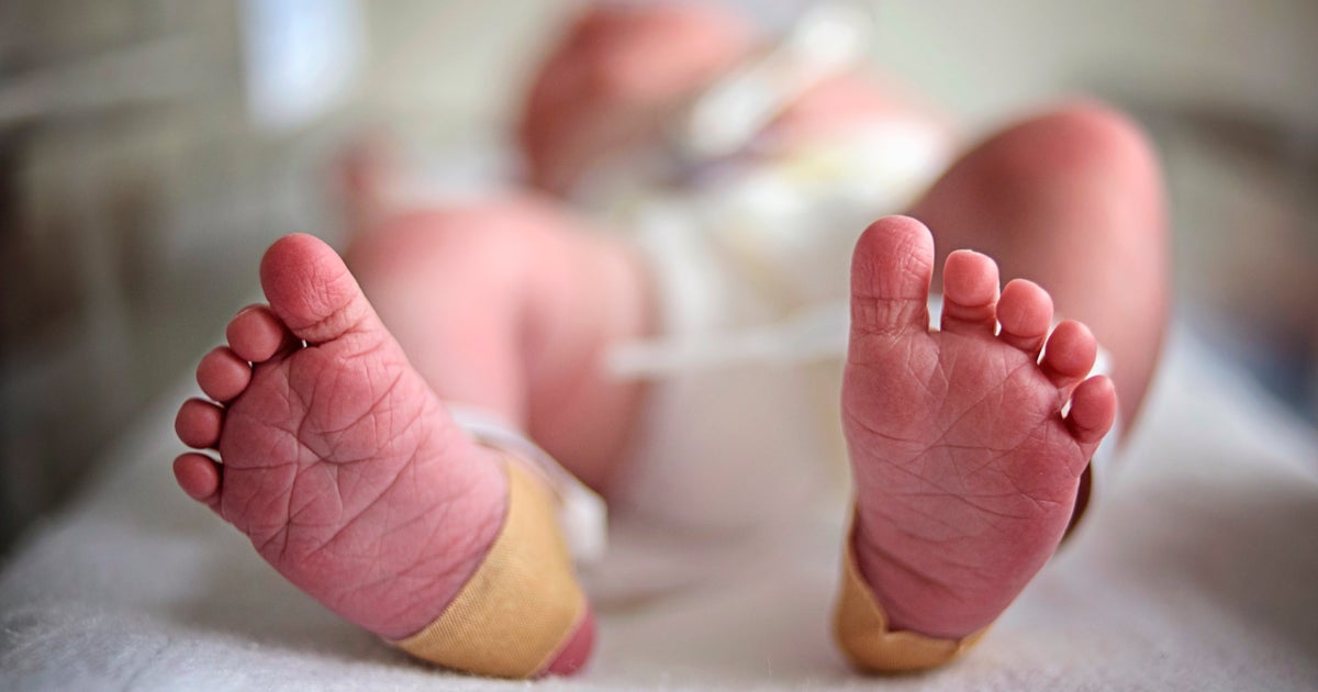 「一日も早く家族のもとへ」米・新生児集中治療室（NICU）の赤ちゃんたちのハロウィン仮装に温かい声
