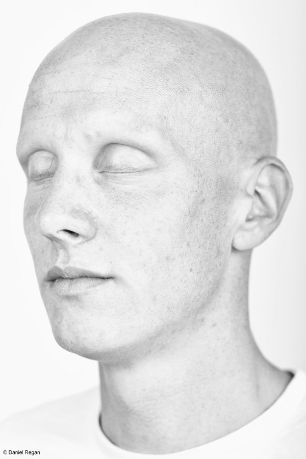 Powerful Photos Of People With Alopecia Prove Bald Is Beautiful | HuffPost